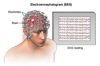 qeeg cap