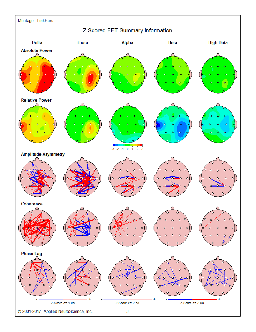 QEEG